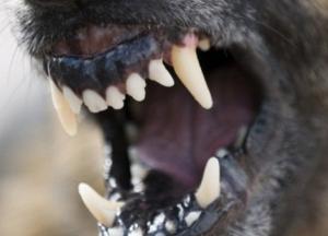 В Кировоградской области бешеная овчарка покусала трех человек 