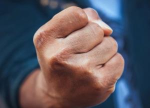 В Киеве избили прокурора