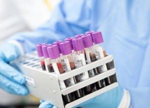 Названа длительность иммунитета у переболевших COVID