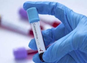 На Буковине подтвердили более 1800 заражений коронавирусом