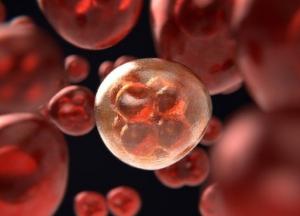 Медики назвали новые симптомы рака крови