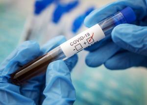 В Украине 17 569 новых случаев коронавируса