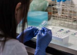 Медики объяснили, какие боли могут быть признаком высокого холестерина