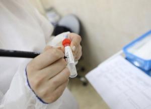 В Украине впервые почти 20 тысяч новых случаев коронавируса