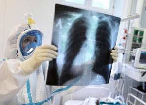 В Украине впервые более 8 тысяч новых случаев коронавируса