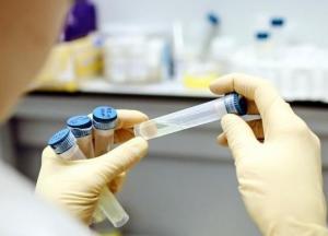 В Украине за сутки 3 615 новых случаев коронавируса