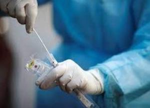 В Украине более 2,5 тысячи новых случаев коронавируса