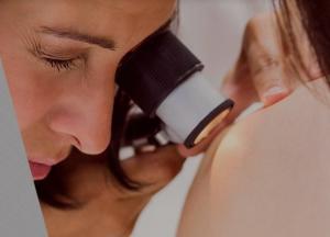 Новообразования на коже — повод обратиться к врачу?