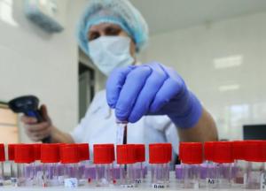 В Украине зафиксировано 3372 случая COVID-19, из них 98 летальных