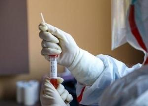 Коронавирус в Украине: кто может сдать ПЦР-тест бесплатно