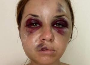 Избиение в поезде: сотрудники УЗ предлагали жертве взятку