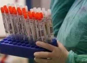 В Украине минимальный за месяц прирост COVID-19