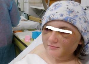 Бил ногами и палкой: в Херсоне парень жестоко поиздевался над экс-возлюбленной