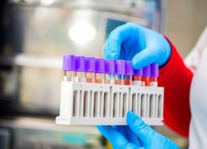 В Украине уже 86 тыс. случаев COVID-19, за сутки - 1 592