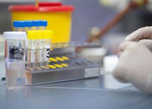 Украина ожидает тест-системы, которых хватит для исследования 5 тысяч образцов на коронавирус