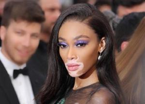 Знаменитая модель с редкой болезнью кожи впечатлила общество на кинофестивале в Каннах (фото)