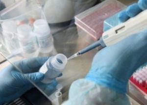 Коронавирус? В Украине еще два месяца назад больницы были переполнены пациентами с вирусной пневмонией (видео)