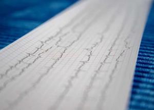 Медики обнаружили неожиданную причину инсультов