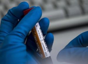 В Украине зафиксировано 1892 случая COVID-19, из них 57 летальных