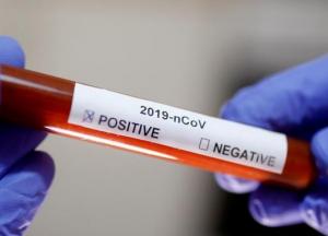 Тесты на коронавирус могут не показать инфекцию: медики раскрыли правду