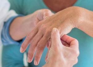 Названы неочевидные признаки артрита