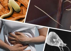 Названы симптомы заражения паразитами