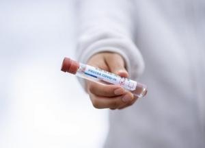 COVID "изменяет судьбу" клеток поджелудочной железы – ученые