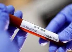 COVID-19 выявили у пяти жителей Обуховского района Киевщины