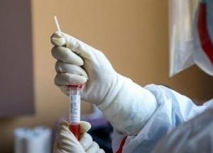 В Украине делают до 3000 тестов на COVID-19 в день