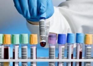 В Украине впервые более 14 тысяч новых случаев коронавируса