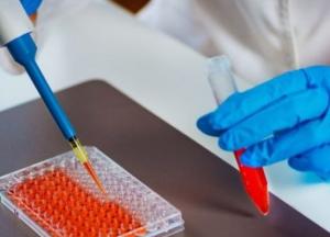 В Киеве ТЦ и рестораны обязали проводить ИФА-тесты работникам