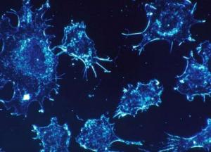 Ученые назвали человеческую болезнь, которая поразила динозавров 