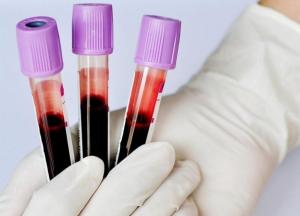 Врачи назвали группу крови, обладатели которой чаще становятся долгожителями