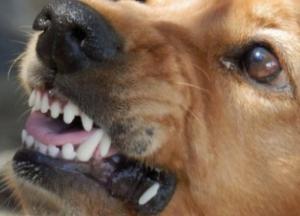 Открытая черепно-мозговая травма: в Бахмуте собака покусала ребенка