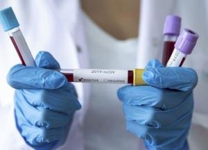 В Украине за сутки 2 772 новых случая коронавируса