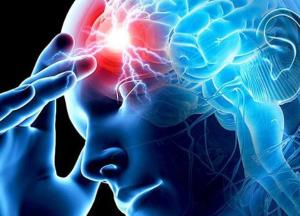 Ученые назвали симптомы, проявляющиеся за месяц до инсульта