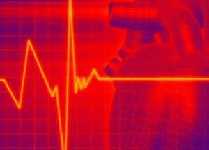 Врачи объяснили, как снизить пульс при тахикардии