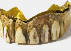 В Британии нашли 200-летнюю вставную челюсть из золота и кости (фото)