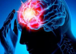 Медики назвали сигналы, предупреждающие об инсульте