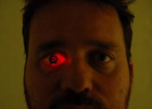 Мужчине встроили камеру вместо глаза (фото)