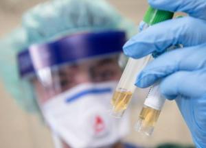 Китайские ученые допустили, что COVID-19 может передаваться половым путем