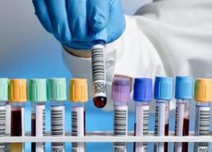 В Украине впервые более 5 тысяч новых случаев коронавируса