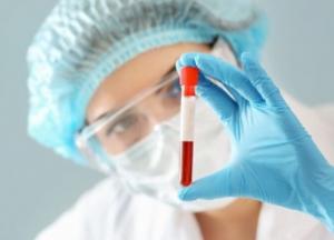 В Украине очередной антирекорд по коронавирусу: 5804 новых случая