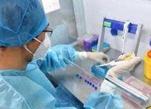 В Украине 417 новых случаев коронавируса