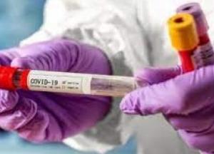 В Украине 696 новых случаев коронавируса