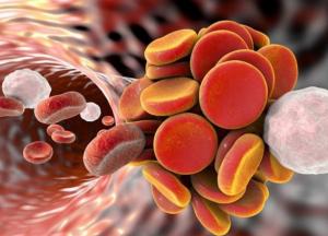 Врачи рассказали о симптомах образования тромба