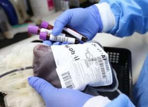 Медики назвали неочевидные признаки густой крови