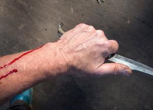 В Харькове мужчина в припадке ревности ударил жену ножом (фото)
