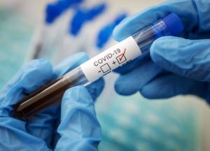 В Украине увеличится тестирование на коронавирус