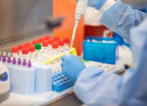 В Офисе президента сказали, сколько в Украине ПЛР-тестов и сколько еще ожидается